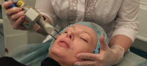 Фракционное лазерное омоложение кожи лица